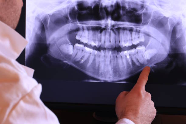 Best Walk-In Emergency Dentist in Ovid, MI