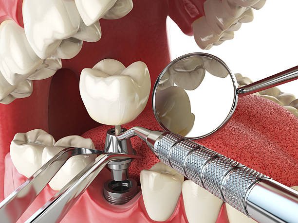Best Emergency Dental Care for Trauma or Injury in Ovid, MI
